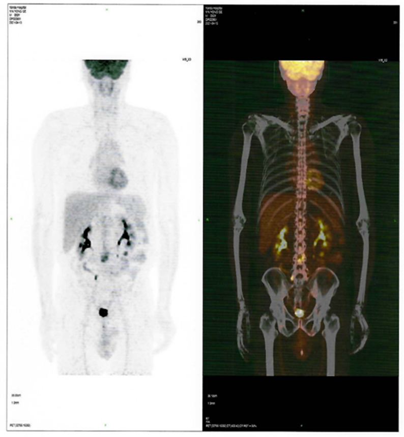 60b878e79c972.png 60b878e79c972.png