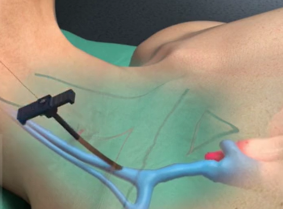 62eb309c068c8.png 62eb309c068c8.png