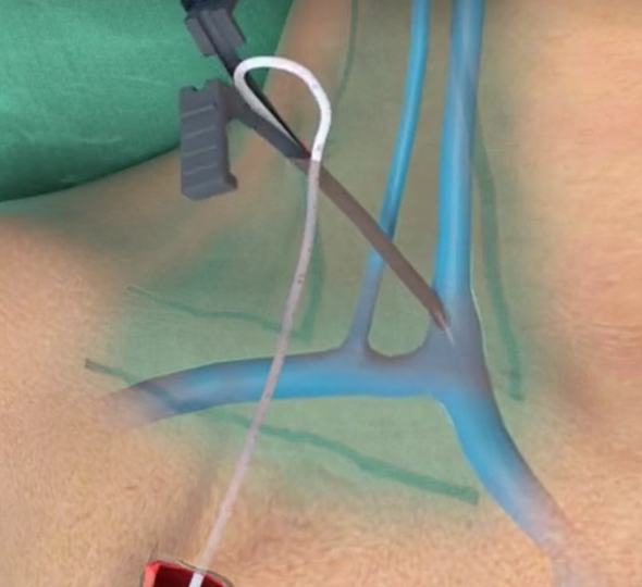 62eb30b3012e4.png 62eb30b3012e4.png