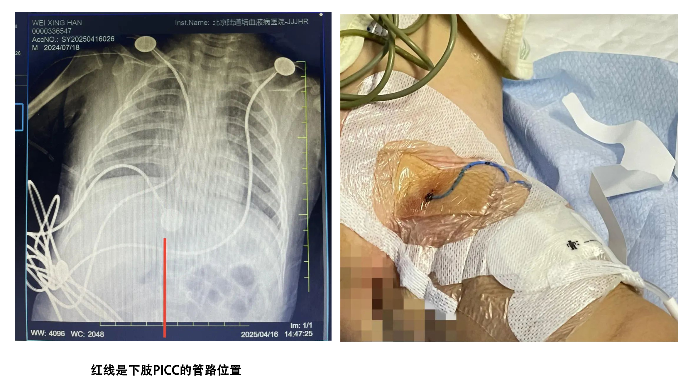 68196f52a5350.jpg 68196f52a5350.jpg