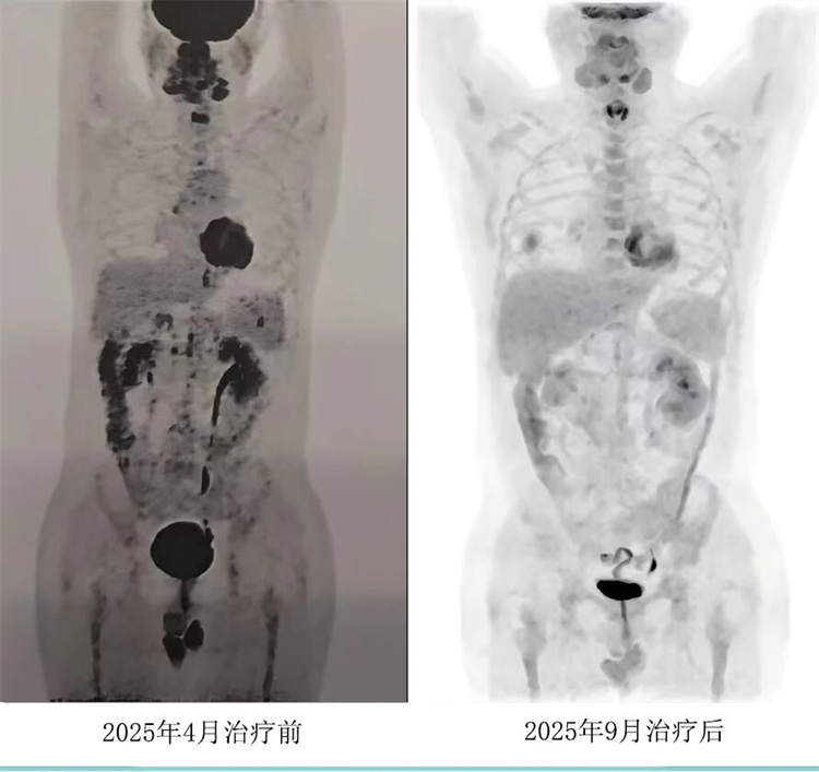 692428d0959f5.jpg 692428d0959f5.jpg